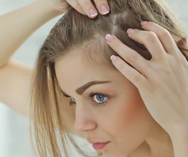 hair thinning on sides