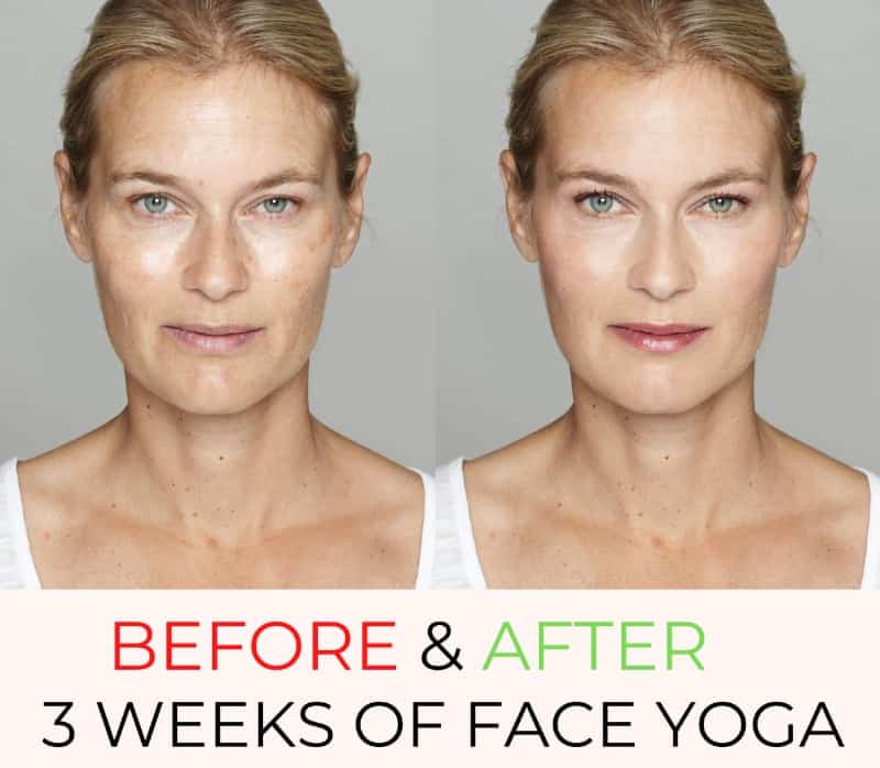 before after weeks of face yoga women