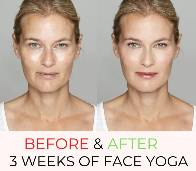 before after weeks of face yoga women