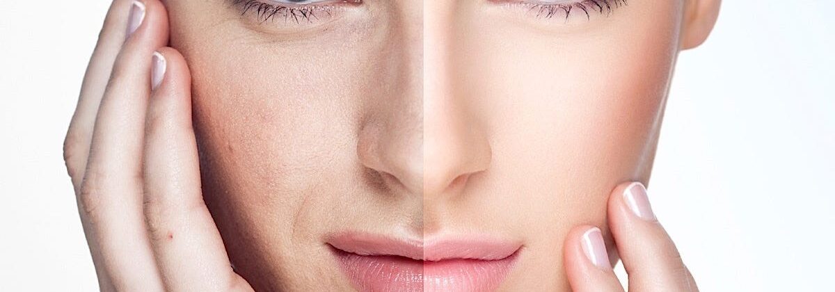 Rejuvenate Your Skin Naturally