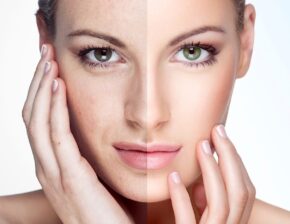 Rejuvenate Your Skin Naturally