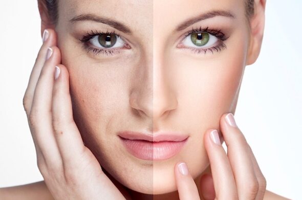 Rejuvenate Your Skin Naturally