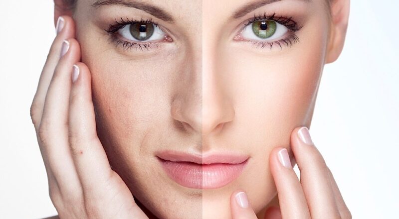 Rejuvenate Your Skin Naturally