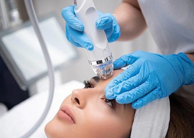 RF Microneedling benefit RF Microneedling benefit