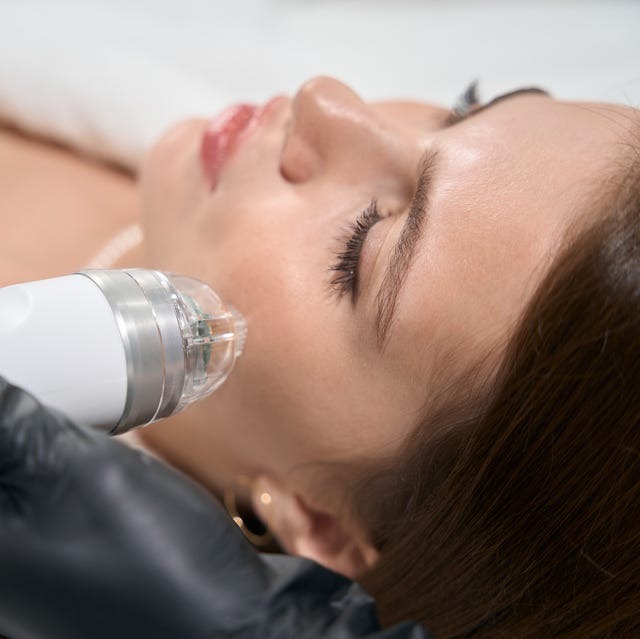 Treatment Experience RF Microneedling Treatment Experience RF Microneedling